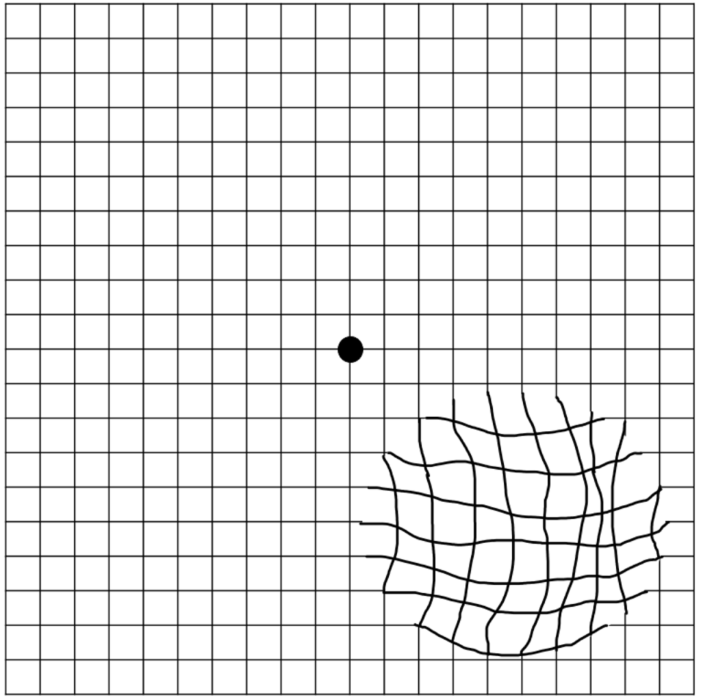 Distortion grids