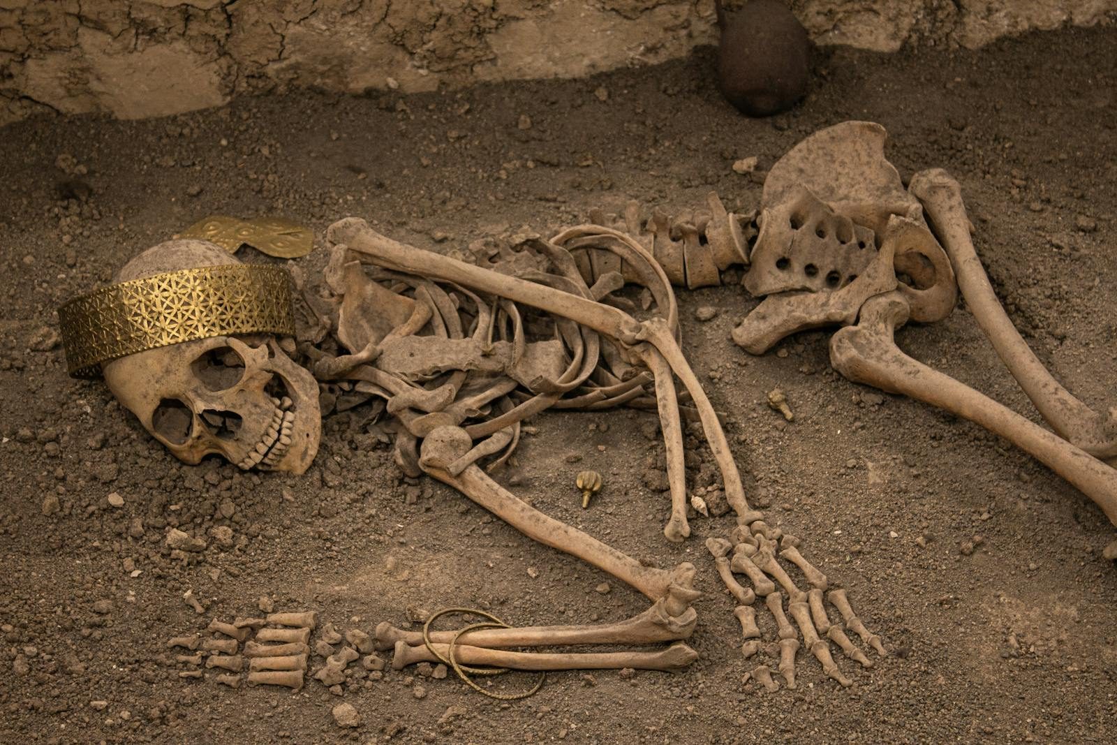 Unearthed skeleton with golden crown discovered in Çorum, Türkiye, showcasing rich ancient history.